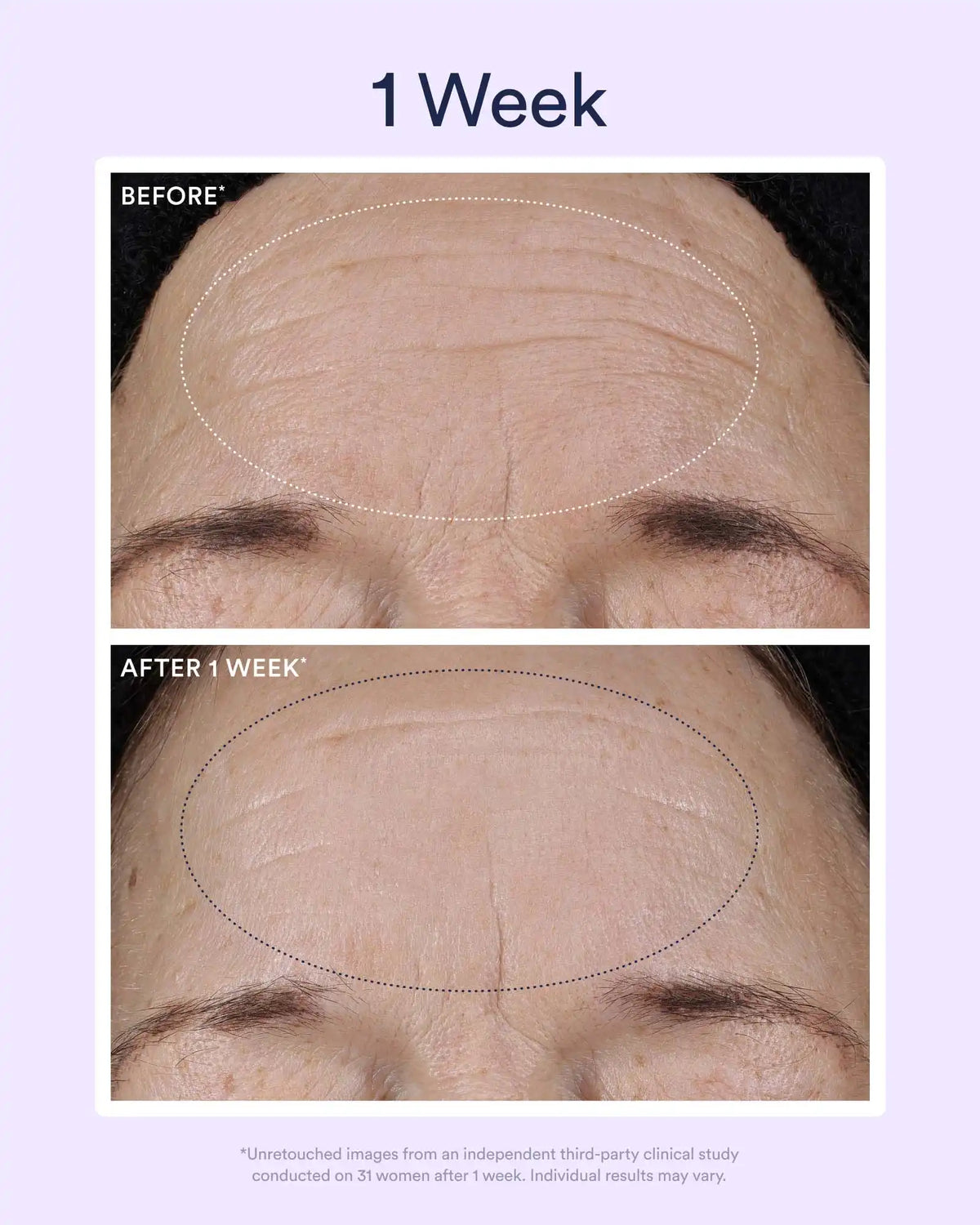 Dream Night Serum with Bio-Retinol