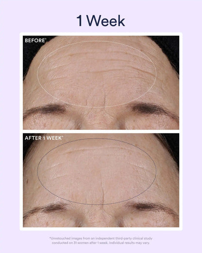 Dream Night Serum with Bio-Retinol